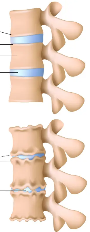 Name:  osteochondrosis.png
Views: 192
Size:  212.1 KB